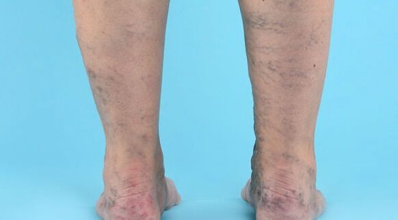 Krankheitserkrankung