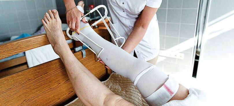 Kompressionsstrümpfe zur Behandlung von Krampfadern